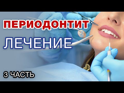 Лечение периодонтита - это риск? Можно ли вылечить периодонтит? / Часть 3