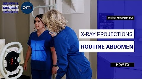 How to Position for Routine Abdomen X-Ray Projections