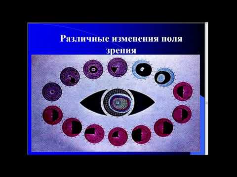 9:40 Зрительные функции. Нарушение бинокулярного зрения.