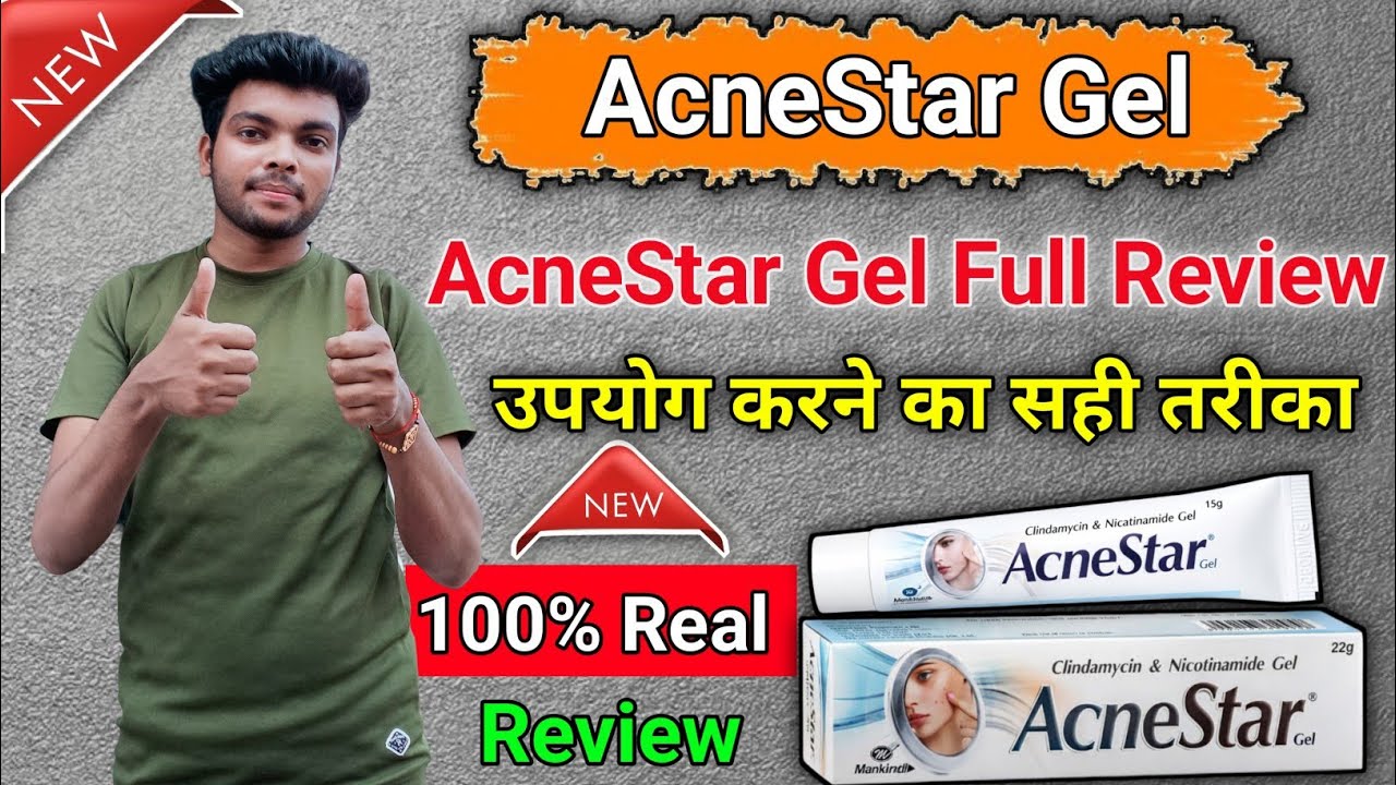 AcneStar Gel Review | AcneStar Gel लगाने से पहले ये वीडियो जरूर देख ले | AcneStar Gel Kaise use kare