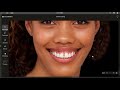 DTS PRO AI Tutorials : Diastema closure