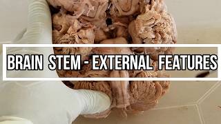 Brain stem - External  Features