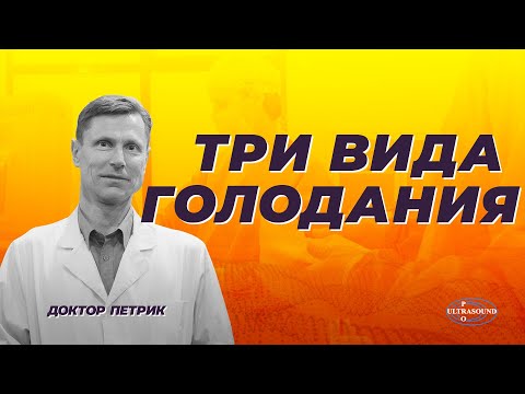 Стиль голодания по- разному влияет на организм. Как выбрать подходящее вам.