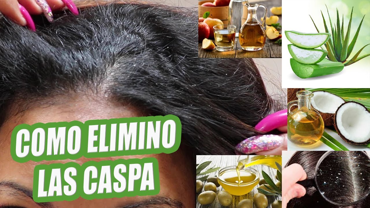 TIPS - Como quitar las CASPAS DEL con ALOE VERA (SABILA) ACEITE DE COCO Y OTROS MAS... - YouTube