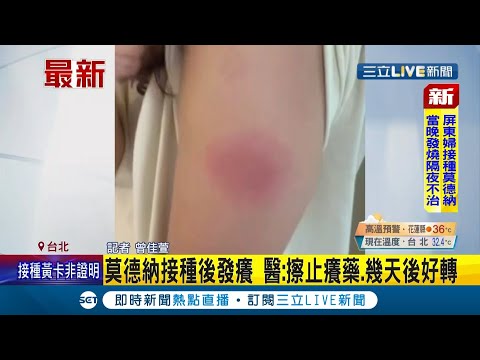 接種後出現"莫德納手臂"約3.5%人紅腫發癢 專家:擦止癢藥.幾天後好轉｜記者 曾佳萱｜【LIVE大現場】20210711｜三立新聞台