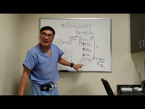 Video: Anhidrosis - Gejala, Rawatan, Bentuk, Peringkat, Diagnosis