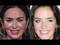 Before & After Photos Of Celebrities Who Regret Their Plastic Surgery