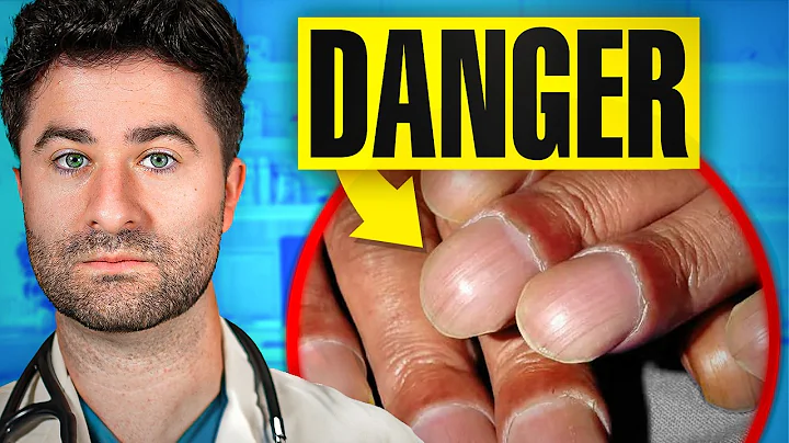 What Your NAILS Say About Your HEALTH: Doctor Explains