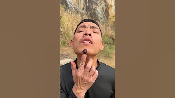 How I Cured a Bug Bite with Yogurt in the Wild Survival Hacks