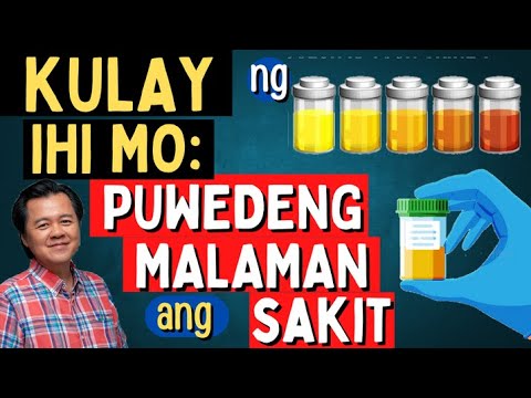 Kulay ng Ihi Mo: Pwedeng Malaman ang Sakit - By Doc Willie Ong (Internist and Cardiologist)