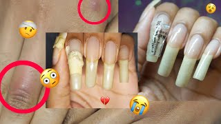 What on Earth Happened?? 😳😔😅 Putting My Worst, but ☝🏽 Longest Natural Nails Ever Back Together!✨