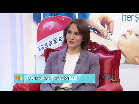 Biyonik göz ve