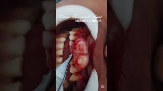 Odan Dental_ Cirugia bucomaxio Facial e Implantologia dental