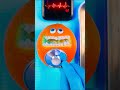 Foaming at the mouth – Surgical ICE CREAM Extraction ! 🍦🍊 Emergency #FruitSurgery #DiscountDentist
