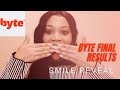 BYTE ALIGNERS FINAL RESULTS | SMILE REVEAL 😬