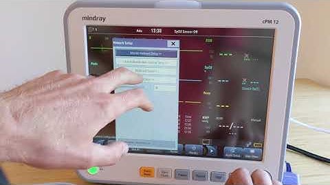 AnesthesiaCharting.com Mindray monitor automatic vitals integration