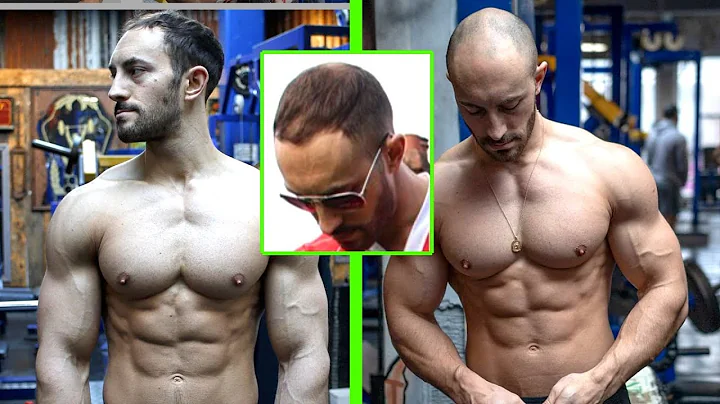 DEALING WITH BALDING IN AN IMAGE FOCUSED WORLD - W...