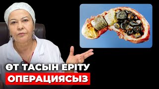 видео: 31 жылдық дәрігер ескертеді ! | Өттегі тасты еріту | Өт тасын түсіру жолдары картинка: 31 жылдық дәрігер ескертеді ! | Өттегі тасты еріту | Өт тасын түсіру жолдары