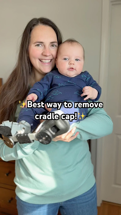Best Way to Remove Cradle Cap! 👶 #momhacks #babymusthave #babybath #momlife #cradlecap
