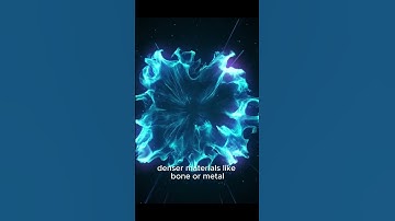 Did you know how X ray works? #shorts #xray