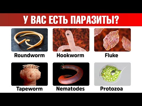 9 признаков паразитов в организме. Средства от глистов👌