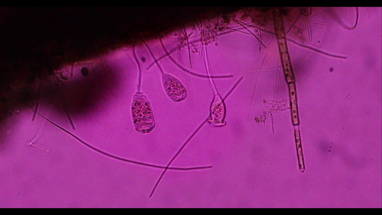 Discover Vorticella: The Bell-Shaped Aquatic Microorganism