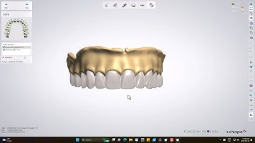 Copy Denture Design
