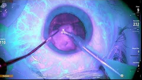 Autofluorescence filter details enhancement in phase Lukan Mishev