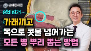 목 뒤로 끝없이 넘어가는 가래 콧물 완전히 말려버리는 방법 ㅣ이비인후과 의사도 안 가르쳐주는 비강과 후강에 숨겨진  해부학적 비밀