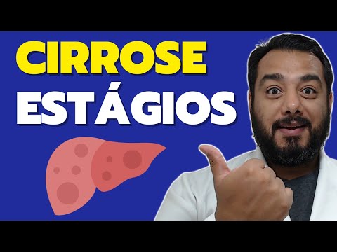 Vídeo: 4 maneiras de reconhecer a cirrose