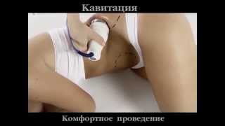 Как быстро похудеть Кавитация Омоложение кожи Похудение Как быстро похудеть Кавитация Омоложение кожи Похудение