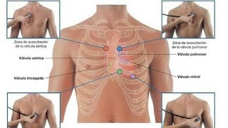 Anatomie du coeur _ Foyers d'auscultation cardiaque