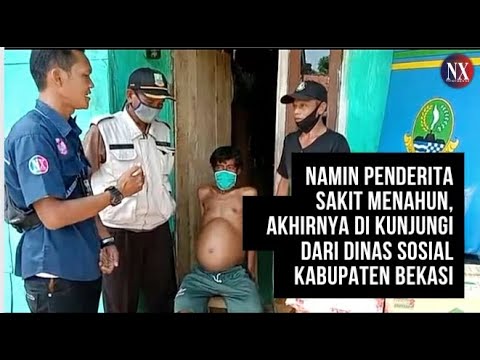 Penderita Sakit Menahun, Akhirnya di Kunjungi dari Dinas Sosial Kabupaten Bekasi