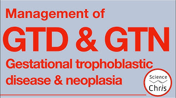 GTD vs. GTN: Differentiation and Management