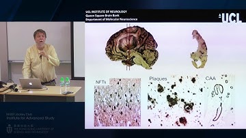 IAS Distinguished Lecture: Prof John Hardy (Sep 4, 2018)