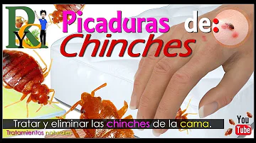 ¿Cómo descartar las picaduras de chinches?