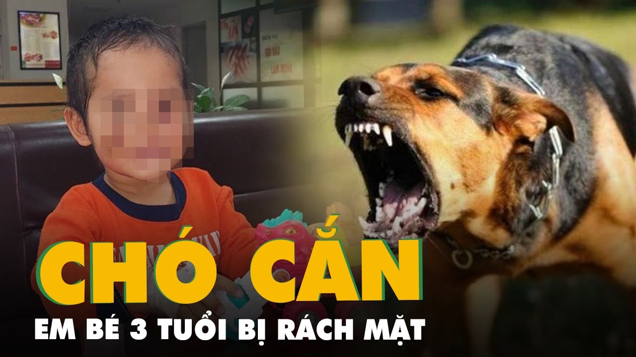 Bé 3 tuổi qua nhà hàng xóm chơi bị chó cắn rách mặt, khâu nhiều mũi ...