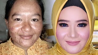 CARA MAKE UP MENUTUP FLEK HITAM BEKAS JERAWAT