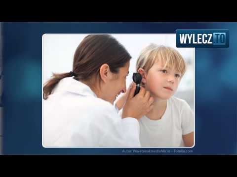 Wideo: Nieżytowe Zapalenie Ucha środkowego - Leczenie Dorosłych I Dzieci