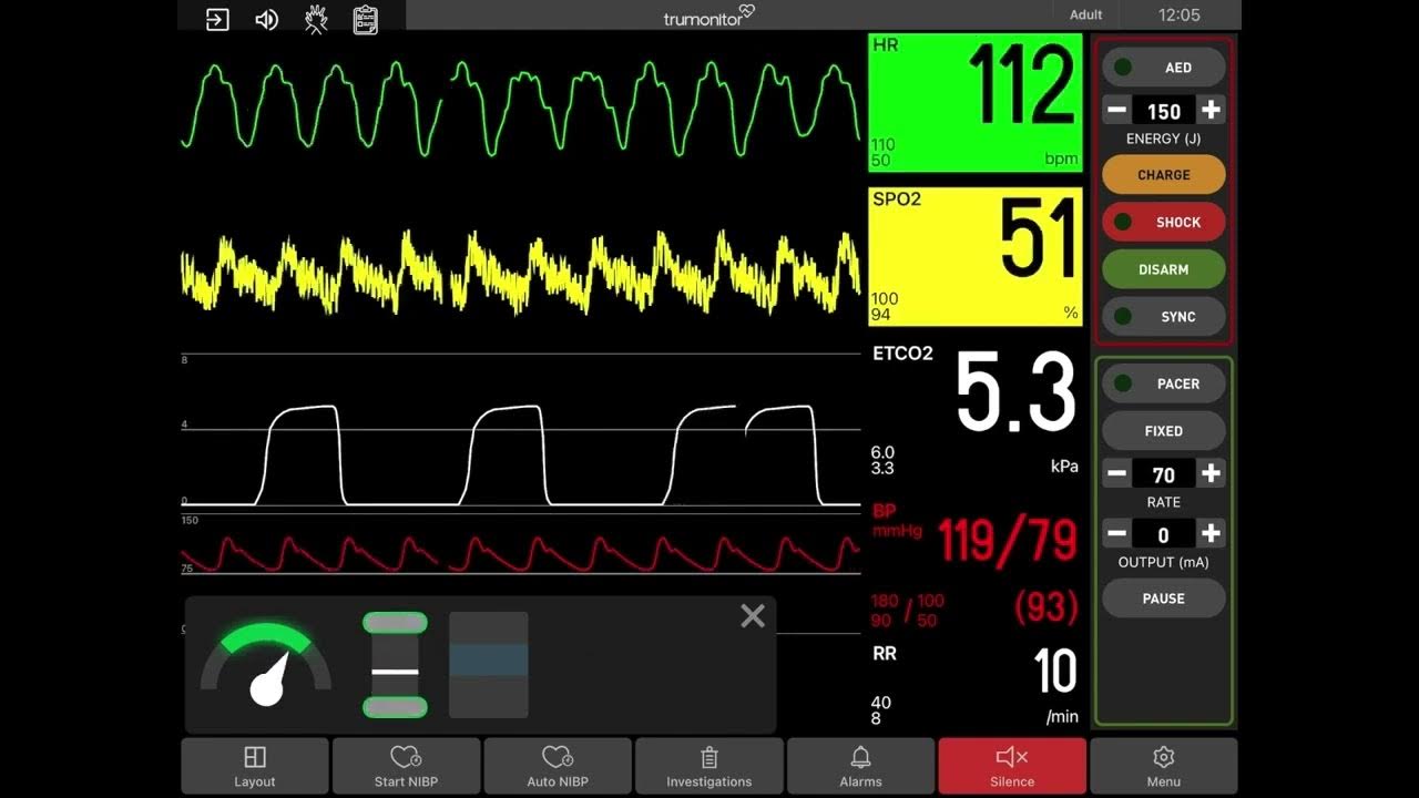 Имитированный монитор пациента TruMonitor App YouTube