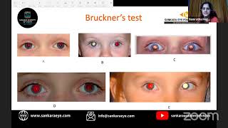 what test ,which age , pediatric optometric exam Learn from the Masters - Sankara Academy of Vision