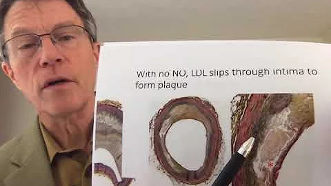 Citrulline: Does it work?  Uses for NO,  ED, Athletics