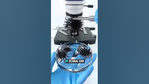 Wat onder de stekels van een zee-egel zit, zal je verbazen