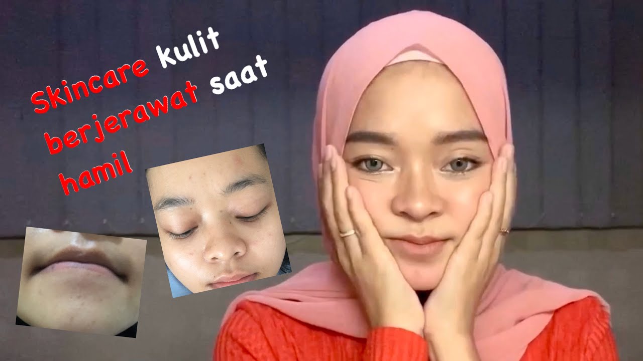 Saat Hamil Hindari 10 Kandungan Skincare Berbahaya Ini Saat Hamil Hindari 10 Kandungan Skincare Berbahaya Ini