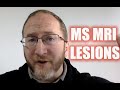 Answering Viewers Questions: MS MRI Scan & Multiple Sclerosis Lesions