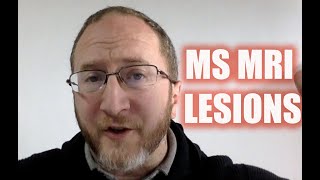 Answering Viewers Questions: MS MRI Scan & Multiple Sclerosis Lesions