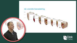 Diak Clinic L Deel 3 Operatieprocedure Voorste Benadering