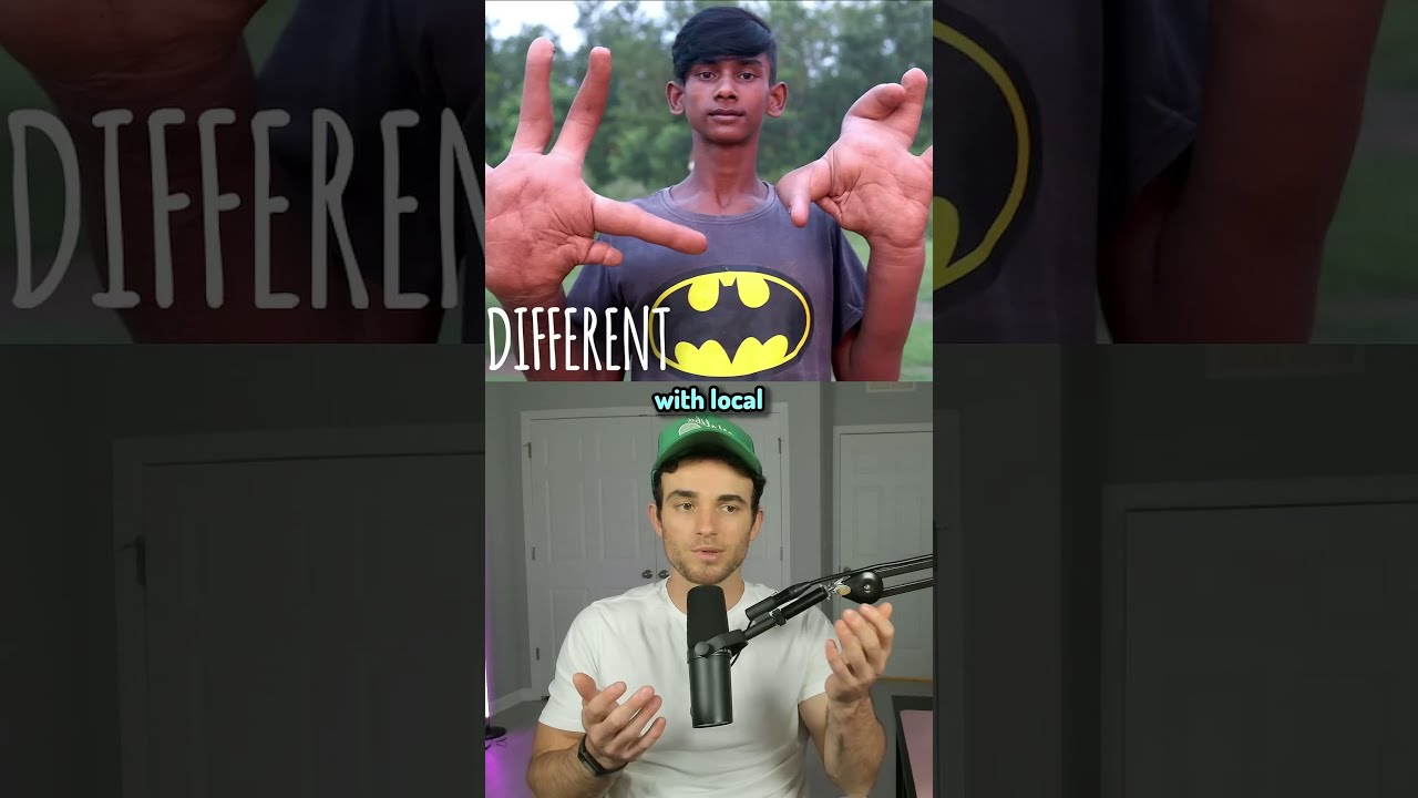 Humans With Super Rare Genetics