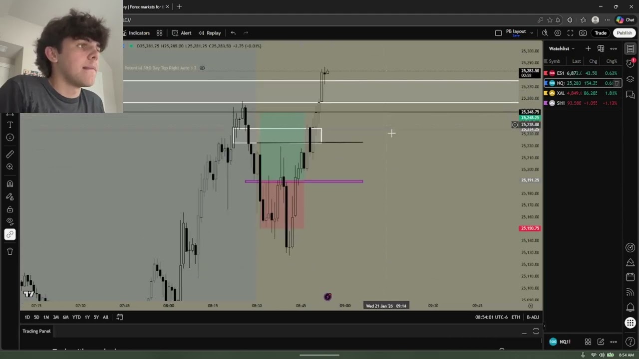17 Year Old DAY TRADER Gets Stop Raided... (Trade Recap)