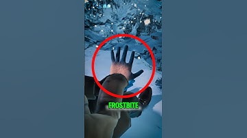 If You Ever Get Frostbite, Do THIS Immediately! #shorts